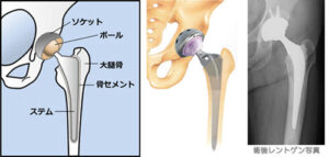 手術のリスク